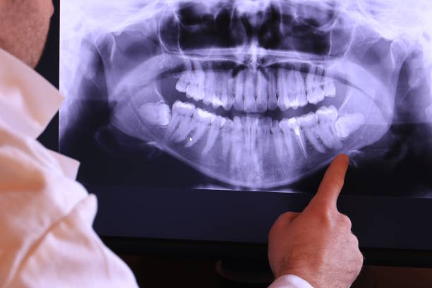 Best Emergency Treatment for Dental Infections or Abscesses in Iola, KS