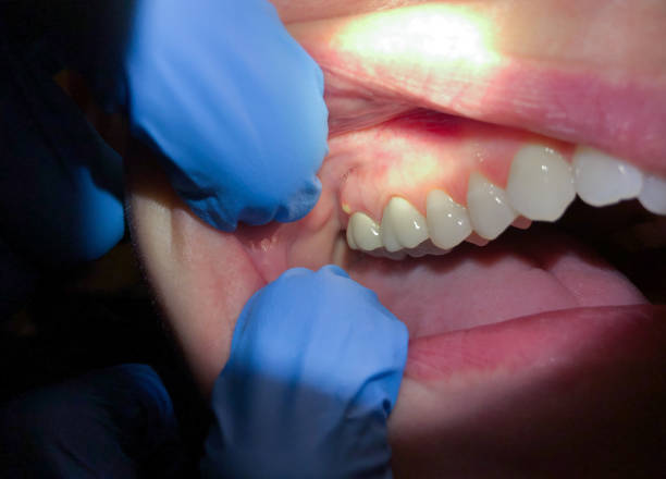 Best Weekend Emergency Dentist in Iola, KS