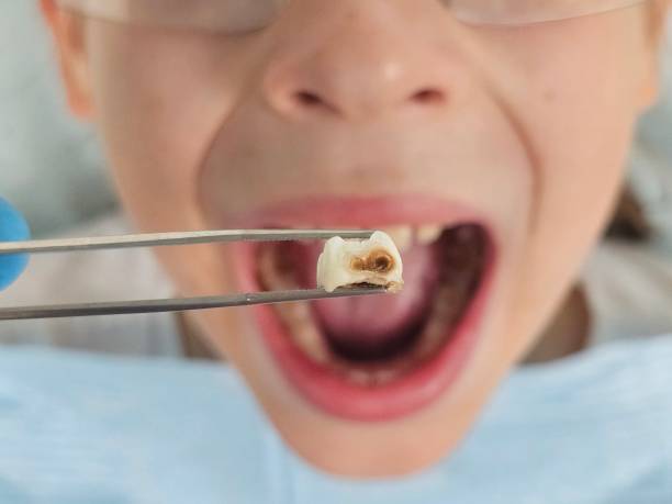 Best Same-Day Emergency Dental Services in Iola, KS
